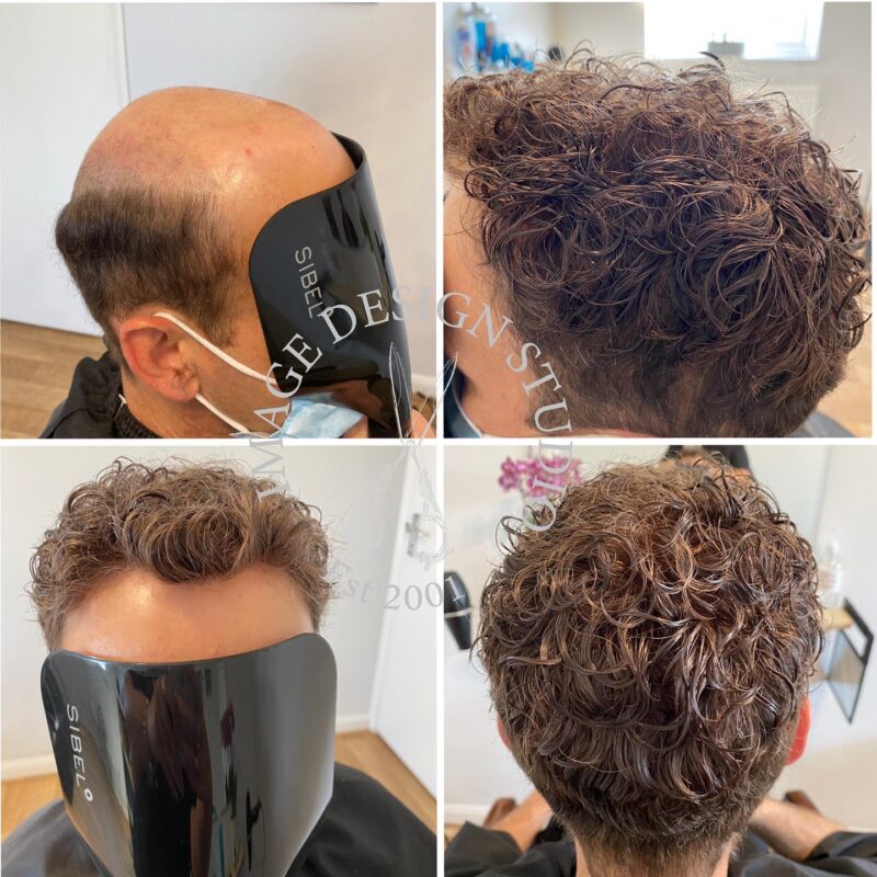 Image Design Studio | Hair Replacement | Laser Treatment | Ladies Hair | Men's Hair