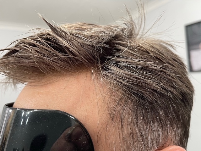 Image Design Studio | Hair Replacement | Laser Treatment | Ladies Hair | Men's Hair