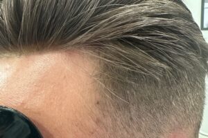 Image Design Studio | Hair Replacement | Laser Treatment | Ladies Hair | Men's Hair